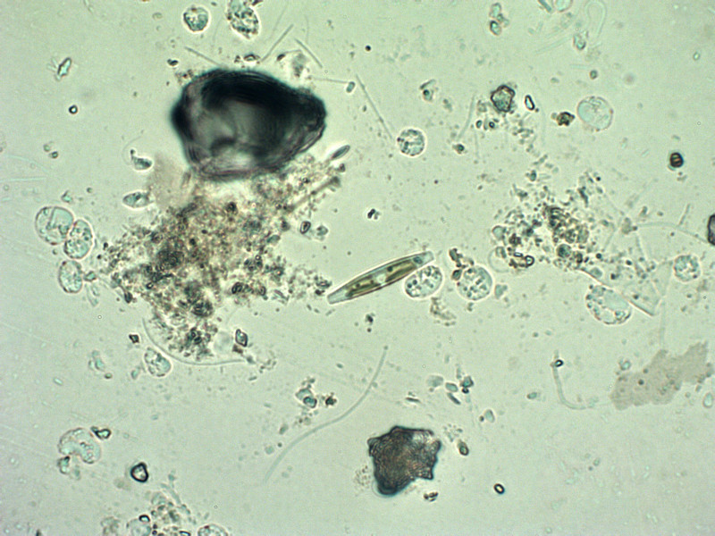 Prima alga osservata